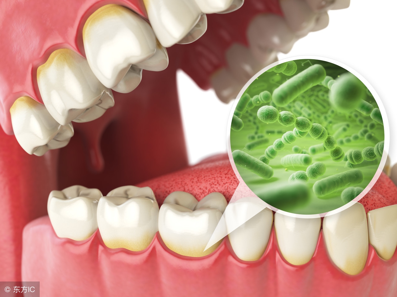 口臭怎么判断消化不良还是胃炎,口臭消化科好治疗吗