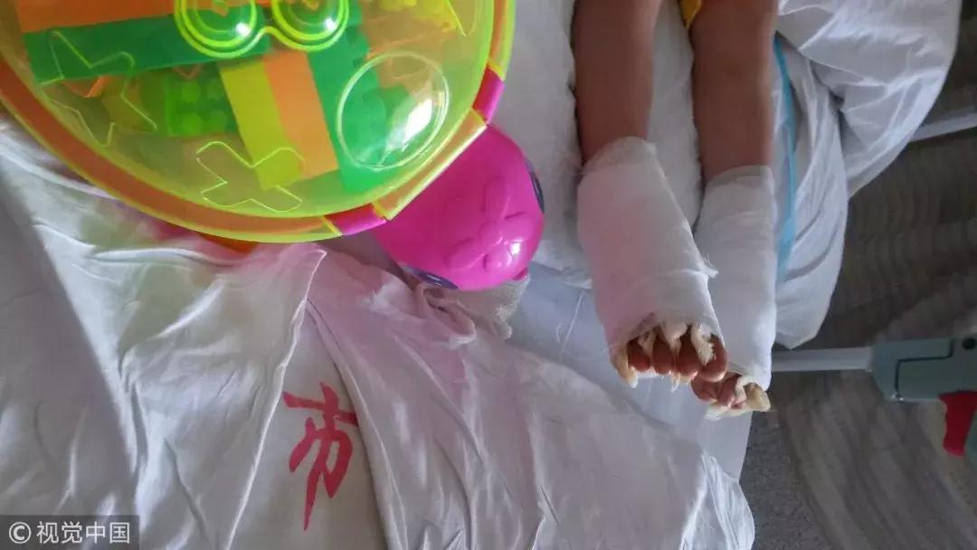 无知家长给孩子生吃蝌蚪,幼童被喂活蝌蚪民间偏方不可取