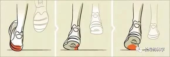 看看你的脊椎到底健不健康？