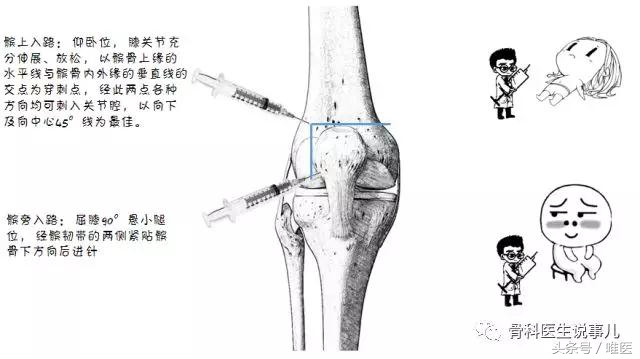 爬楼梯关节痛可以吃消炎药吗,爬楼梯股关节痛