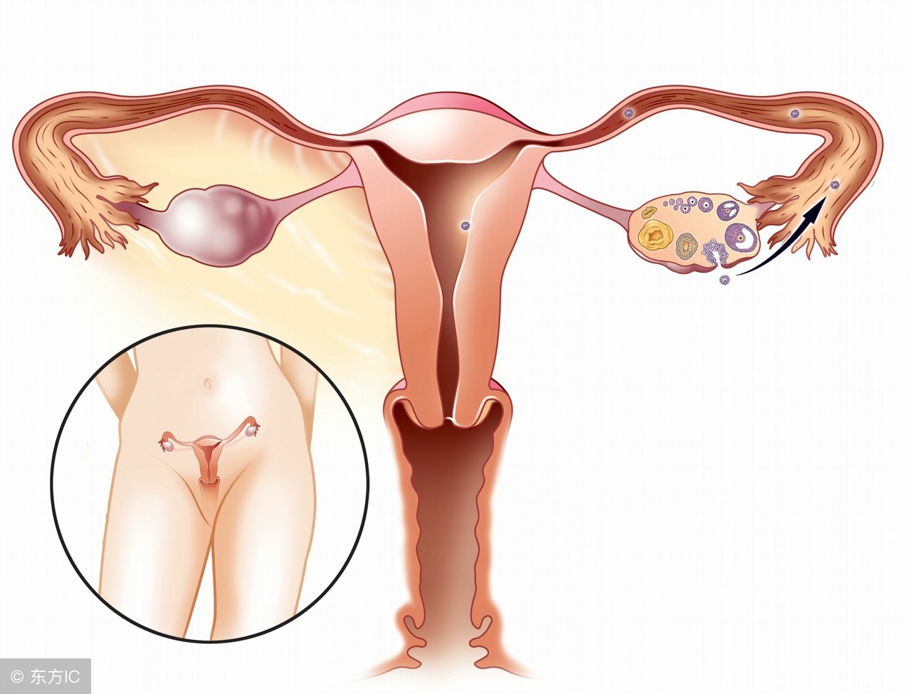 红光雾化治疗宫颈糜烂影响生育吗,宫颈糜烂利普刀手术会影响生育吗