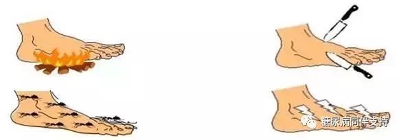 糖尿病神经病变吃b12有用吗怎么吃,预防糖尿病并发症的10个信号