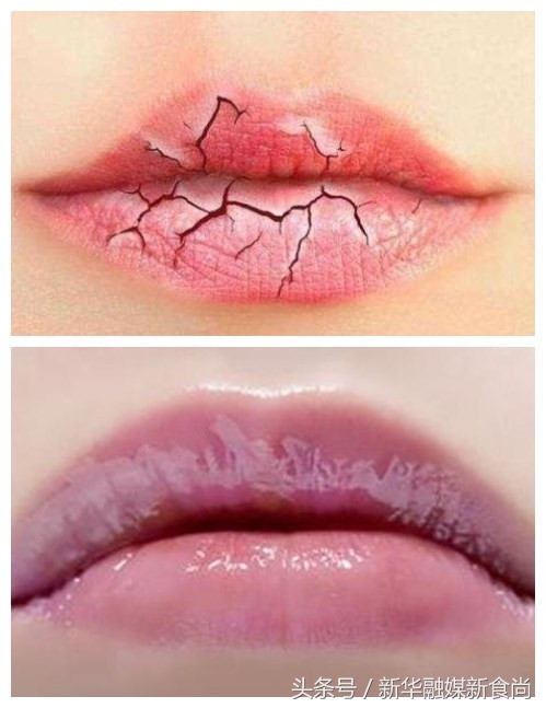 女人春季想不想嘴唇水嘟嘟？快来让花瓣娇艳PK干裂死皮