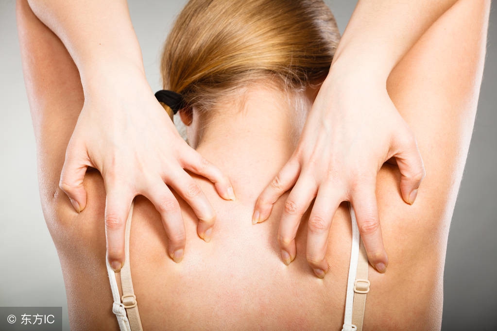湿疹瘙痒的西医疗法,湿疹痒痒用什么药膏