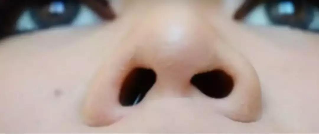 不动刀的隆鼻方法是什么,不动刀不打针的隆鼻的方法