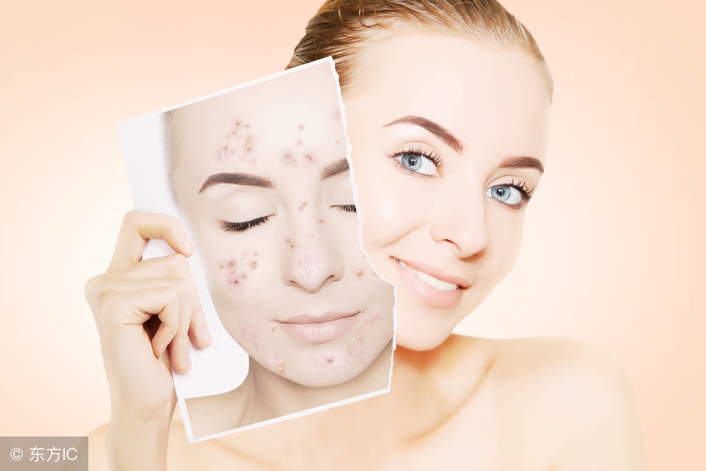 又到了露胳膊腿的季节，教你一招越晒越白的小秘诀