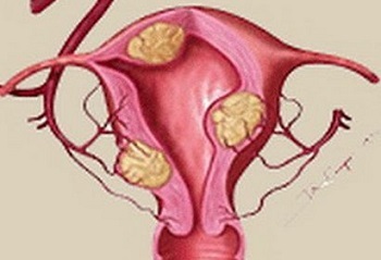 月经量变少是什么原因怎么办,月经量变得很少怎么回事