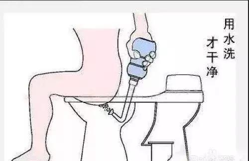 痔疮洗屁屁,每天坚持洗屁屁能预防痔疮