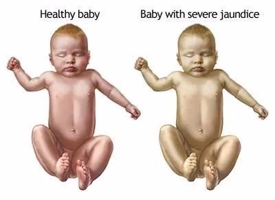 面对产科医生不许结婚生子的无理规定，她说：那我就一辈子不嫁！