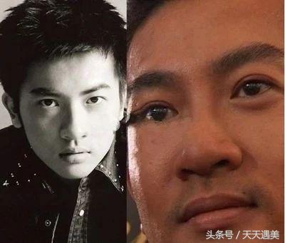 大方承认割双眼皮的明星,戚薇旗下明星