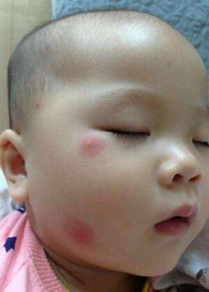 小孩头上有个包一摸会动的,小孩头上的包会动