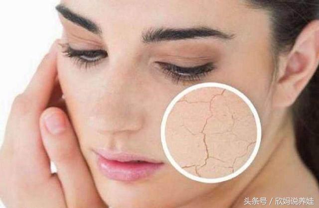 女人脸上有这4个表现，可能被妇科病缠上了，发现一个最好去查下