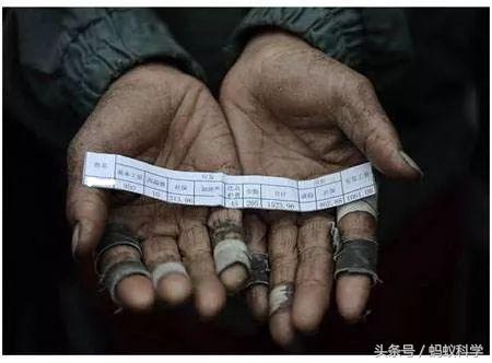 去除前脚掌老茧最佳方法,手上老茧怎么去除小窍门