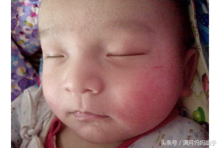 宝宝胳肢窝起红疹子什么原因,宝宝胳肢窝红图片