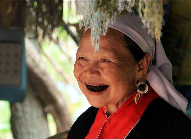 牙齿呈现什么颜色时最健康,牙齿为什么会有斑点