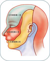 季节性神经痛小妙招,谷雨关节疼