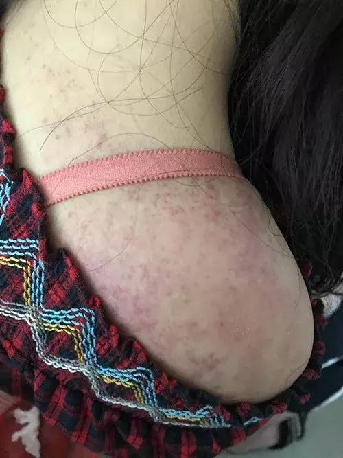 杭州女生打呼噜被舍友卡脖子,大学生打呼噜被舍友打后续