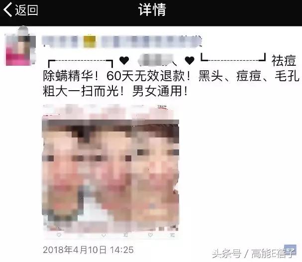 别傻了！蔡徐坤、Angelababy都根治不掉的黑头，微商神器能去除？