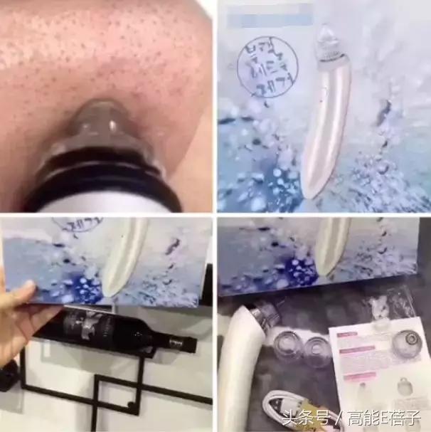 别傻了！蔡徐坤、Angelababy都根治不掉的黑头，微商神器能去除？