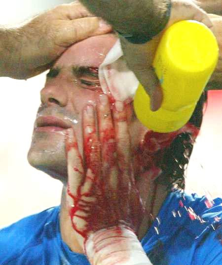 最黑的一届世界杯：韩国连胜3大豪门，12年后公开承认贿赂裁判