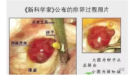 那些为了钱卖自己卵子的女生后来都怎样了？
