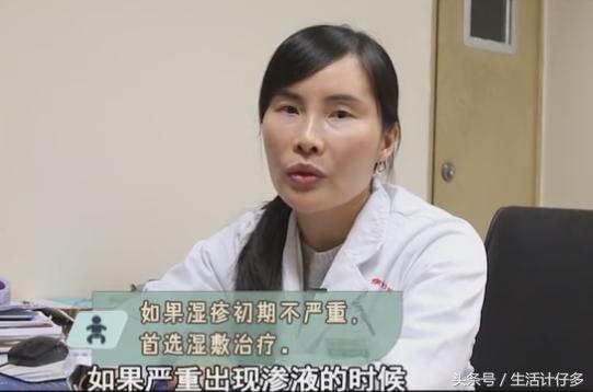 宝宝反复湿疹对付湿疹有妙招,宝宝湿疹反反复复的最佳治疗方法