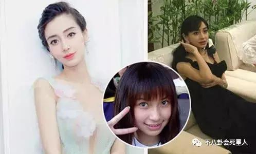 高圆圆戴牙套的脸型变化图,高圆圆戴牙套前后对比照