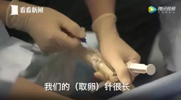 20岁女大学生捐卵,女大学生捐卵案