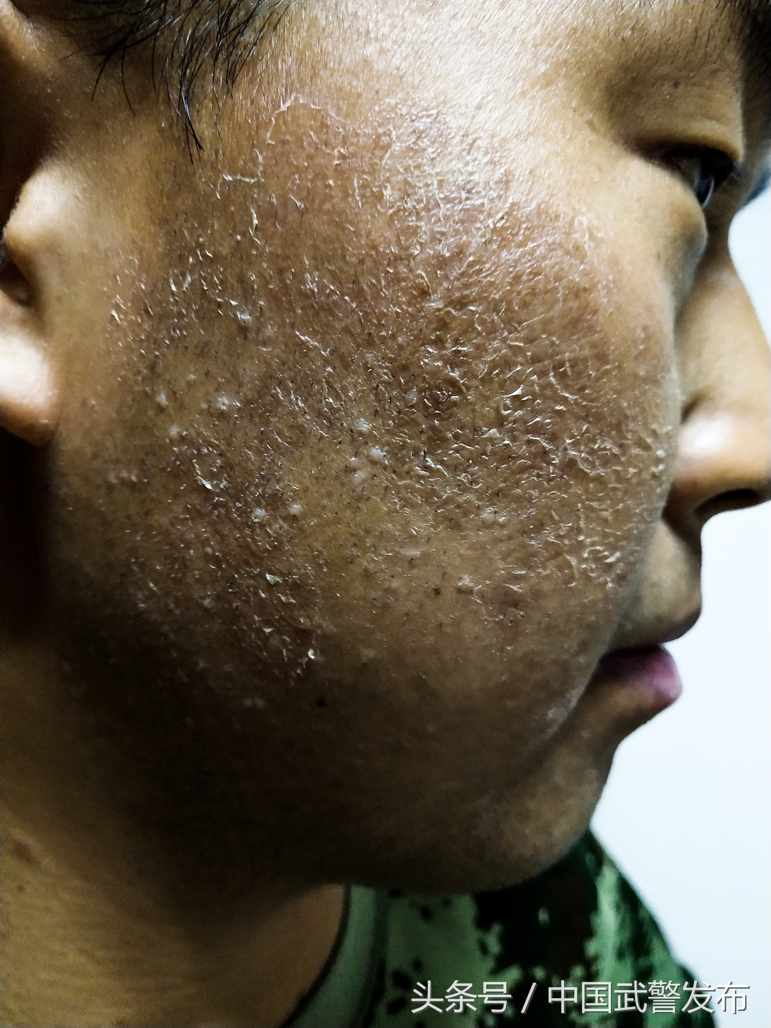 生命之花在雪域高原绽放,青春在雪域高原美丽绽放