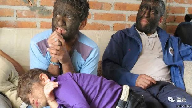 我看了场大尺度畸形人体秀，从此再也没睡过安稳觉！