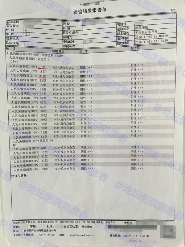 宫颈cin3累及腺体排除宫颈病变,宫颈高度病变cin3累及腺体是癌吗