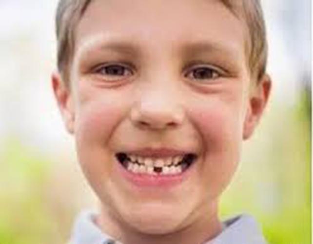 吹的乐器是不是对牙齿不好,吹乐器对牙齿有影响吗