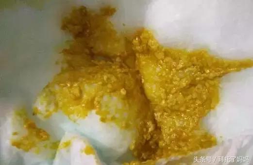 宝宝大便能判断胀不胀气,宝宝大便能看出什么