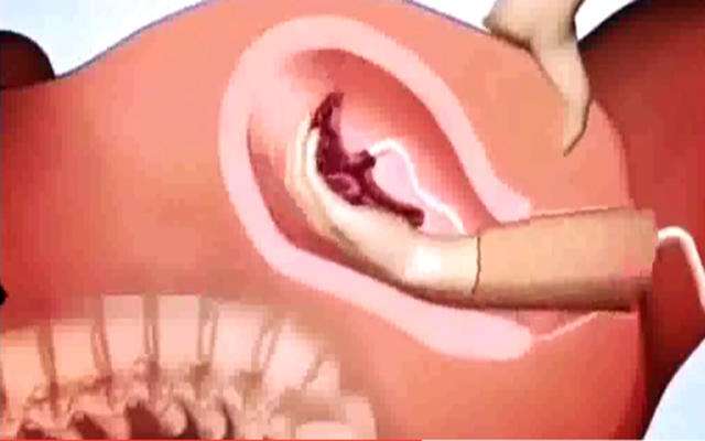 产后各种痛,产后各种痛苦的表现