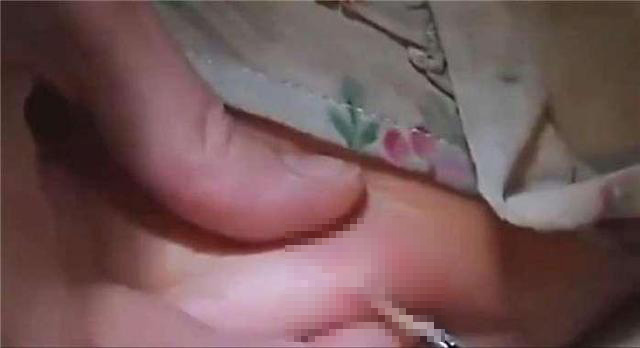 带宝宝回农村虫多,分辨孩子感染寄生虫