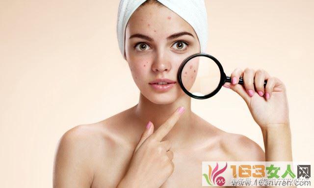 额头长痘的原因和解决方法,额头脸上长痘的原因和解决方法