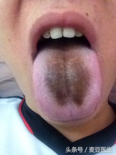 最全中医舌诊图谱来啦!看舌头,知全身!
