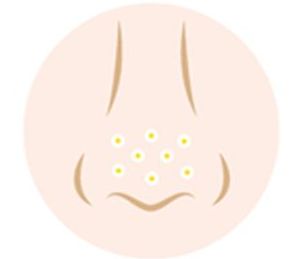 肚脐眼里抠出来粘稠的白色物质,肚脐眼里的泥用镊子取出