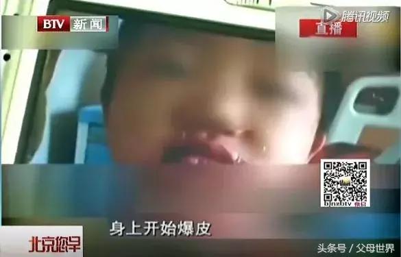 泡泡液对儿童的伤害,小孩泡泡液会导致过敏吗