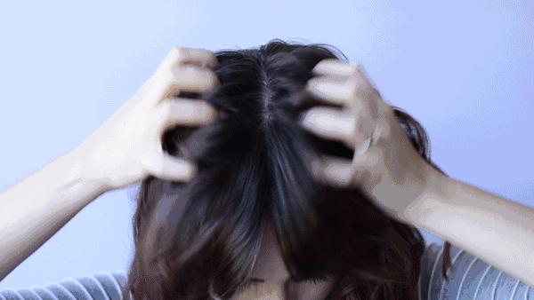 侧柏叶怎么防脱发和生发偏方大全,防脱发偏方用多久见效