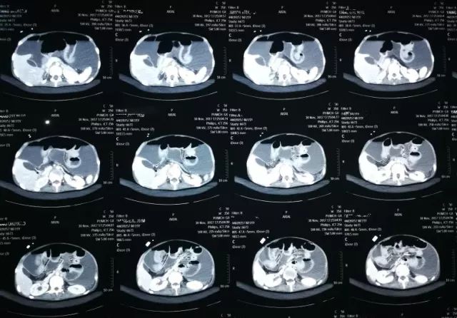 27岁清华医生脑死亡捐器官救5人,27岁清华医生脑死亡捐献器官救5人