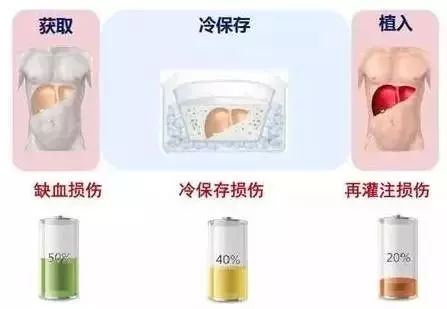 3d打印的肾移植案例,肾移植手术3d