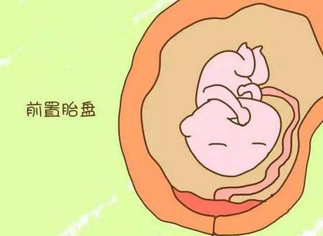 怀孕后还有月经？别不信还真有这事，孕期“出血”的5种情况！