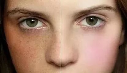 美女一条腿“暴涨”还发红发烫，只因吃了……姑娘们千万别为“大姨妈”乱吃这种药！