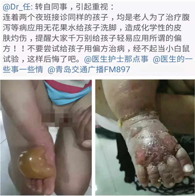 文盲不可怕就怕瞎说话,文盲和医盲的区别