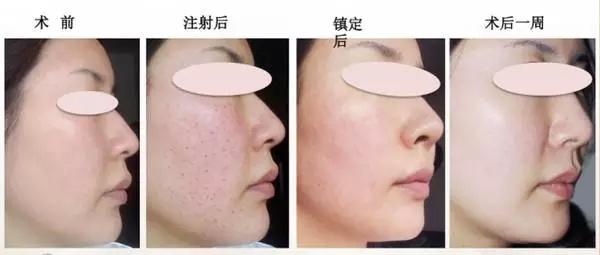 处女脸、果汁脸，你的老公鹿晗林更新们到底心水哪一款？