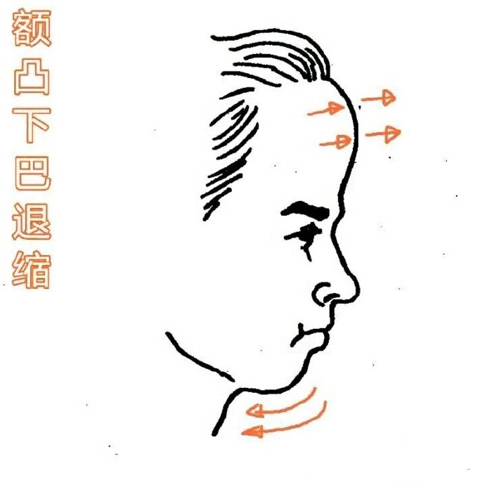 额头高但是额头窄的女人面相,额头两侧比额头中间低面相