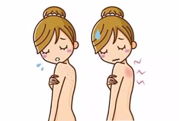 湿疹or痱子教你正确区分与治疗,如何正确判断湿疹与痱子