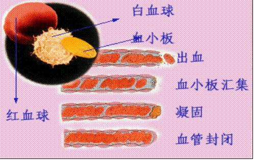 月经量大血流不止怎么回事,月经过多血流不止怎么办