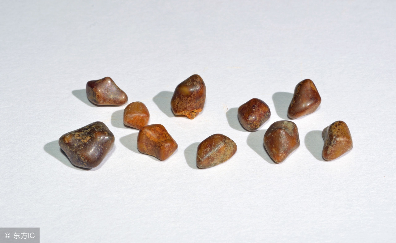 平静的胆结石不安分